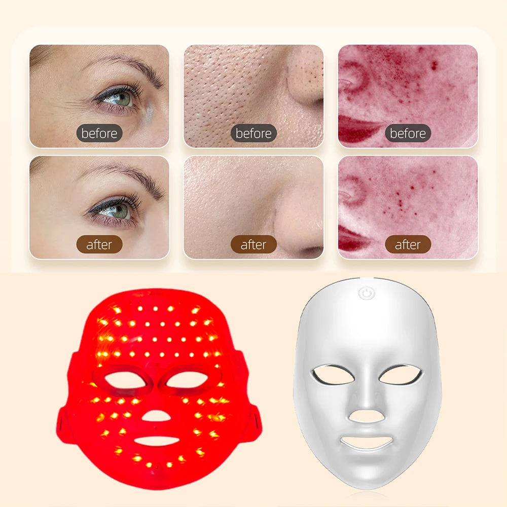 SoftSkin LED Therapy Mask